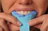 Take teeth impression