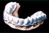 duplicate model of your teeth