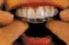 whitening tray in your mouth