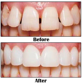 before_after